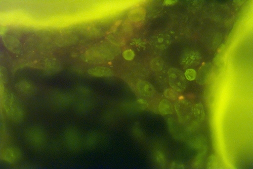 3-D Human lung tissue with luminescent Nano crystals.  Showing chromosome division.